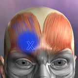 Muscle trigger point anatomie APK