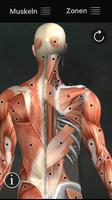 Muskel Triggerpunkte Anatomie Plakat