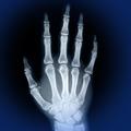 ”Skeletal Anatomy 3D