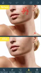 Photo Retouch- Object Removal XAPK download