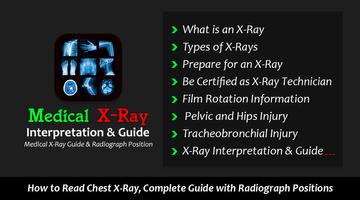 X-Ray Interpretation Guide Affiche