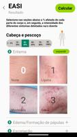EASI SCORAD imagem de tela 2
