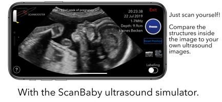 ScanBaby syot layar 2