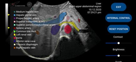 Scanbooster Ultrasound Sim ポスター