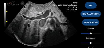 Scanbooster Ultrasound Sim ảnh chụp màn hình 1