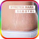 Tips Mengobati Stretch Mark APK