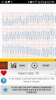 587/5000 心脏诊断（以前）心率监测器 截图 2