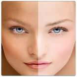 درمان لکه هاي بارداري