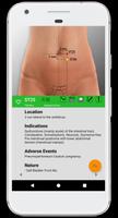AcuPoint - Acupuncture screenshot 3