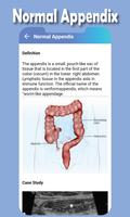 Abdominal Ultrasound Guide screenshot 2