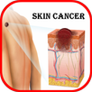 Skin Cancer APK