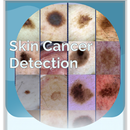 Skin Cancer Detection APK