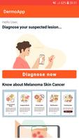DermoApp: Skincancer detection Plakat