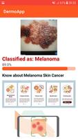 DermoApp: Skincancer detection Screenshot 1