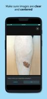 Skin Check: Dermatology App 截图 3