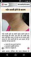 गर्दन का कालापन screenshot 1