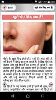 Open Pores Treatment ~ खुले रोम छिद्रों से राहत poster