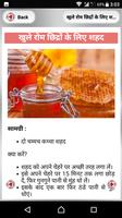 Open Pores Treatment ~ खुले रोम छिद्रों से राहत screenshot 1