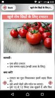 Open Pores Treatment ~ खुले रोम छिद्रों से राहत screenshot 2