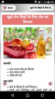 Open Pores Treatment ~ खुले रोम छिद्रों से राहत screenshot 3