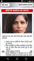 होंठों के कालेपन screenshot 1