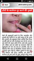होंठों के कालेपन screenshot 2