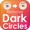 Remove Dark Circles