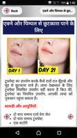 त्वचा देखभाल में टूथपेस्ट screenshot 3