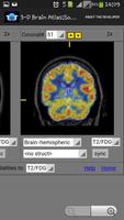 3-D brain Atlas capture d'écran 3