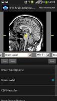 3-D brain Atlas capture d'écran 1