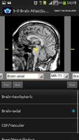 3-D brain Atlas screenshot 1