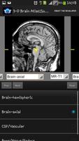 3-D brain Atlas capture d'écran 2
