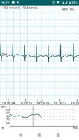 DiaCard - ECG Recorder capture d'écran 1