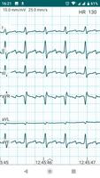 DiaCard - ECG Recorder capture d'écran 2