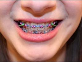 Braces screenshot 1