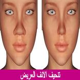 تنحيف الانف العريض (مضمونة)