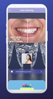 teeth whitening poster
