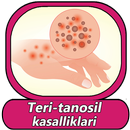 Teri tanosil kasalliklari va u APK