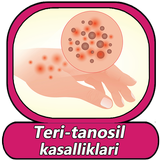 Teri tanosil kasalliklari va u APK