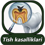 Tish kasalliklari va davosi