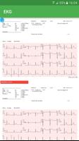 1 Schermata EKG