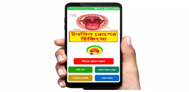 টনসিল রোগের চিকিৎসা ~ Tonsil Disease Treatment