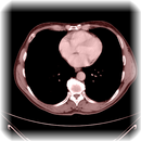 Dicom Medical Image Viewer APK