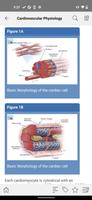 STS Cardiothoracic Surgery poster