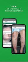 5-Minute Clinical Consult capture d'écran 3