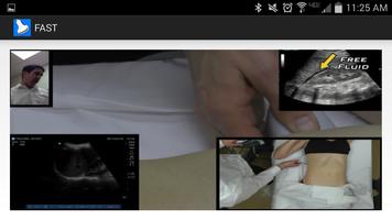 برنامه‌نما One Minute Ultrasound عکس از صفحه