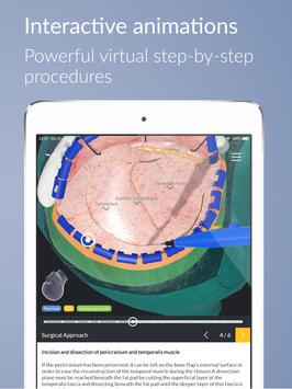 UpSurgeOn Neurosurgery 截图 15
