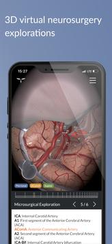 UpSurgeOn Neurosurgery 截图 4
