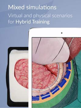 UpSurgeOn Neurosurgery 截图 8