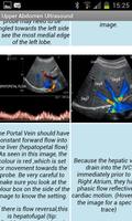 Upper Abdominal Ultrasound Screenshot 2